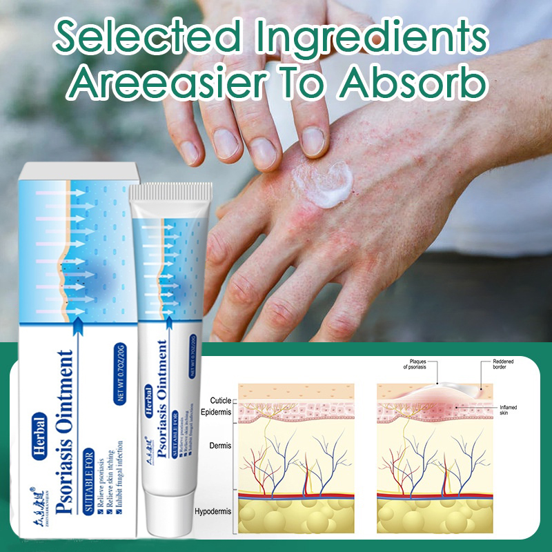 100 Original Authentic Eczema Cream Psoriasis Dermatitis Ointment Health Itching Relief Skin