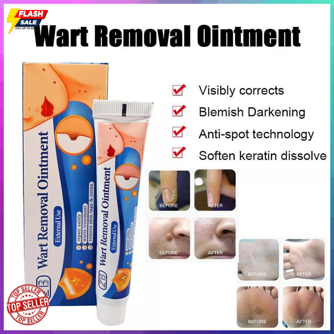 Warts Remover Original Cream Warts Magic Remover Wartz Removal Cream