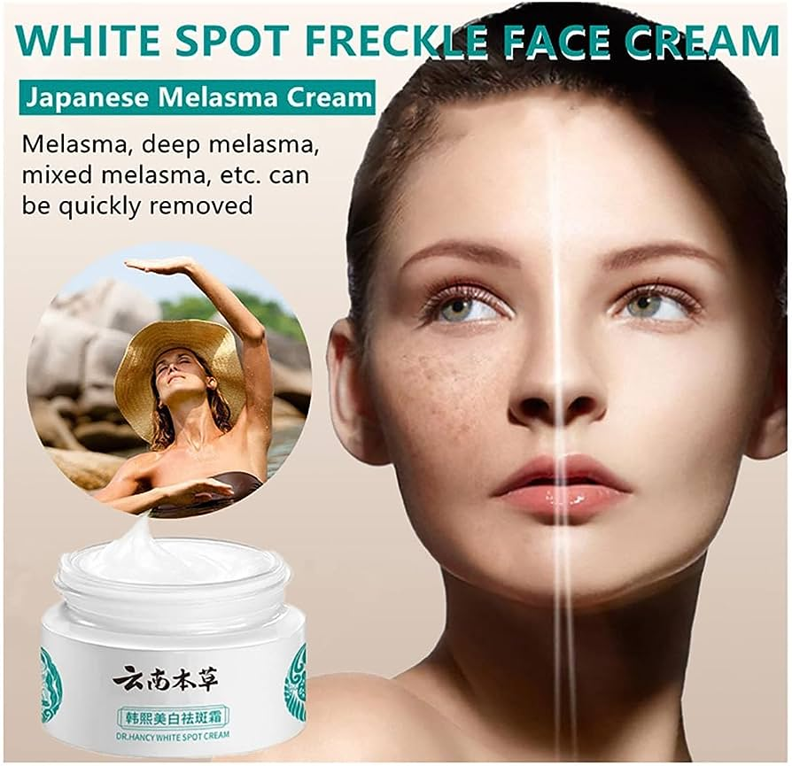 Japanese Melasma Cream Melasma Cream From Japan Yunnan Herbal Whitening