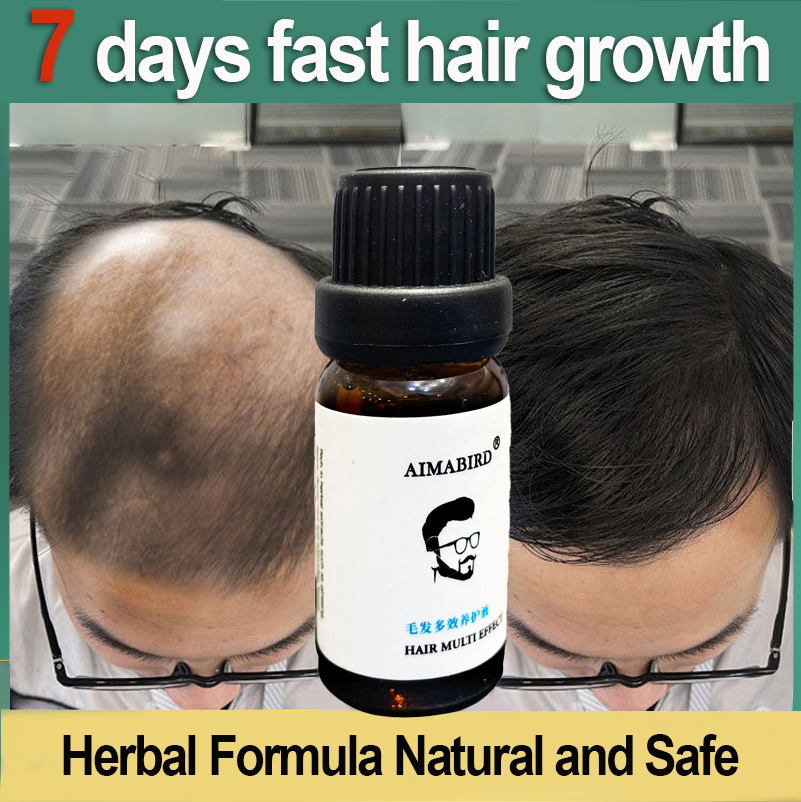 7 days fast hair growth hair growth liquid 10ml solve thinning problems