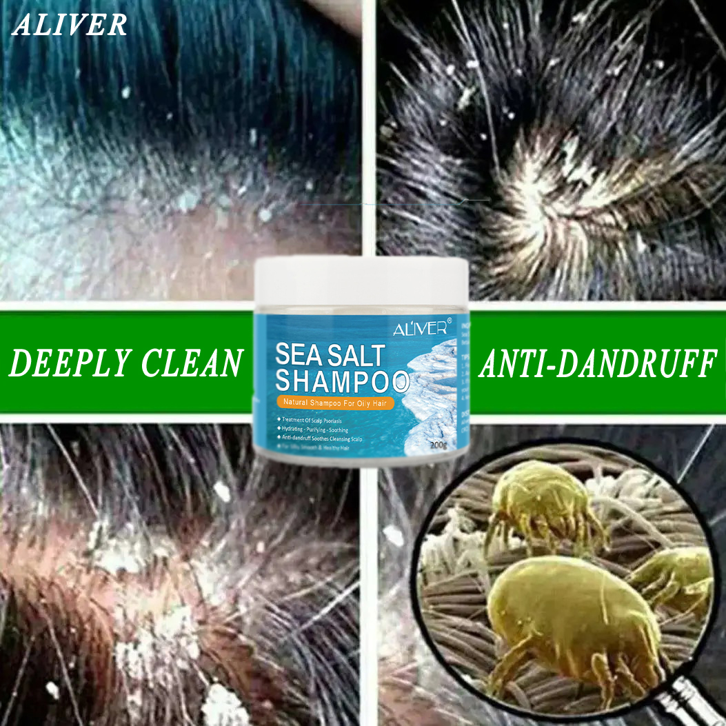 ALIVER Sea Salt Shampoo Sea salt can effectively sterilize and remove  dandruff (Hair Treatment Shampoo / shampoo for scalp psoriasis/Anti-Dandruff  & scalp treatment/dandruff remover shampoo/psoriasis hair shampoo/ mites &  Lice Removal Shampoo) |