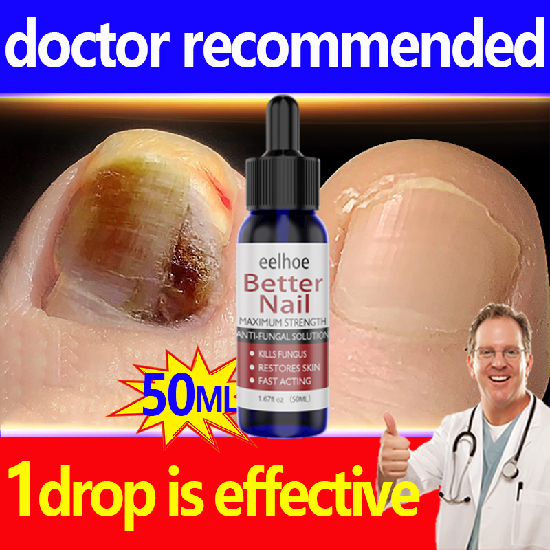 nail fungus treatment serum 50ML nail treatmet fung nail fungus repair