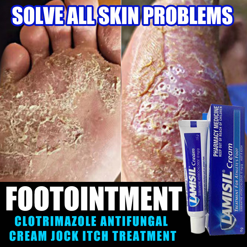 Solve all skin problems👍 Original LAMISIL jock itch cream Foot