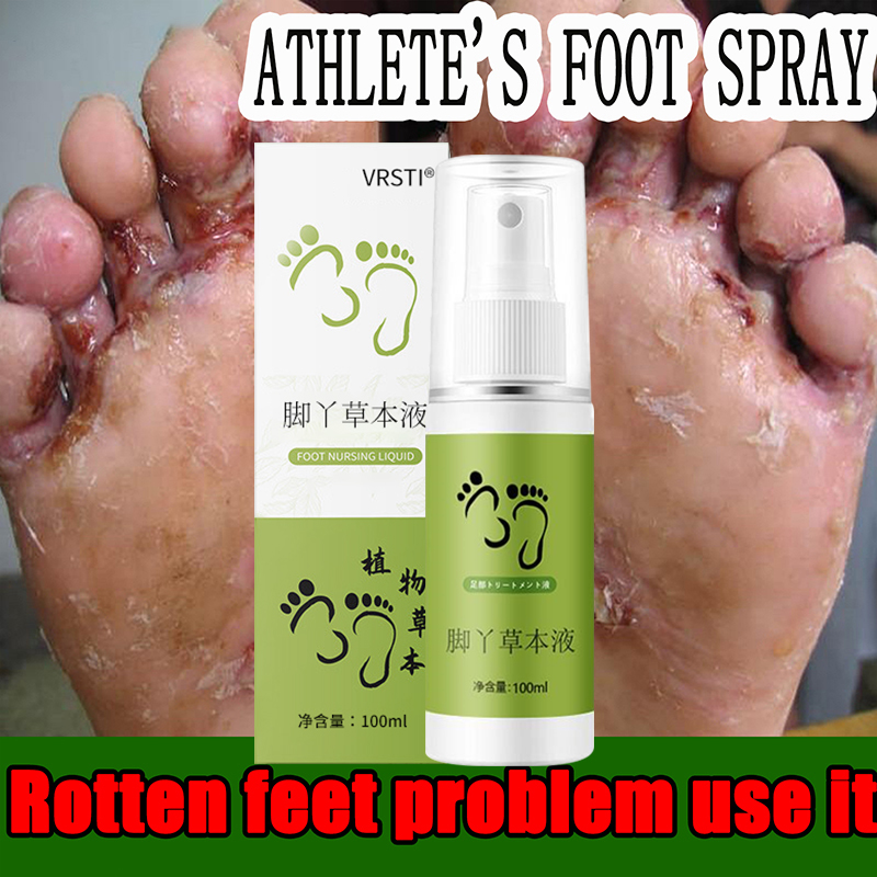 ANTI ODOR DeoFoot AntiOdor AntiSweat Fungal Perspirant Spray 60ML