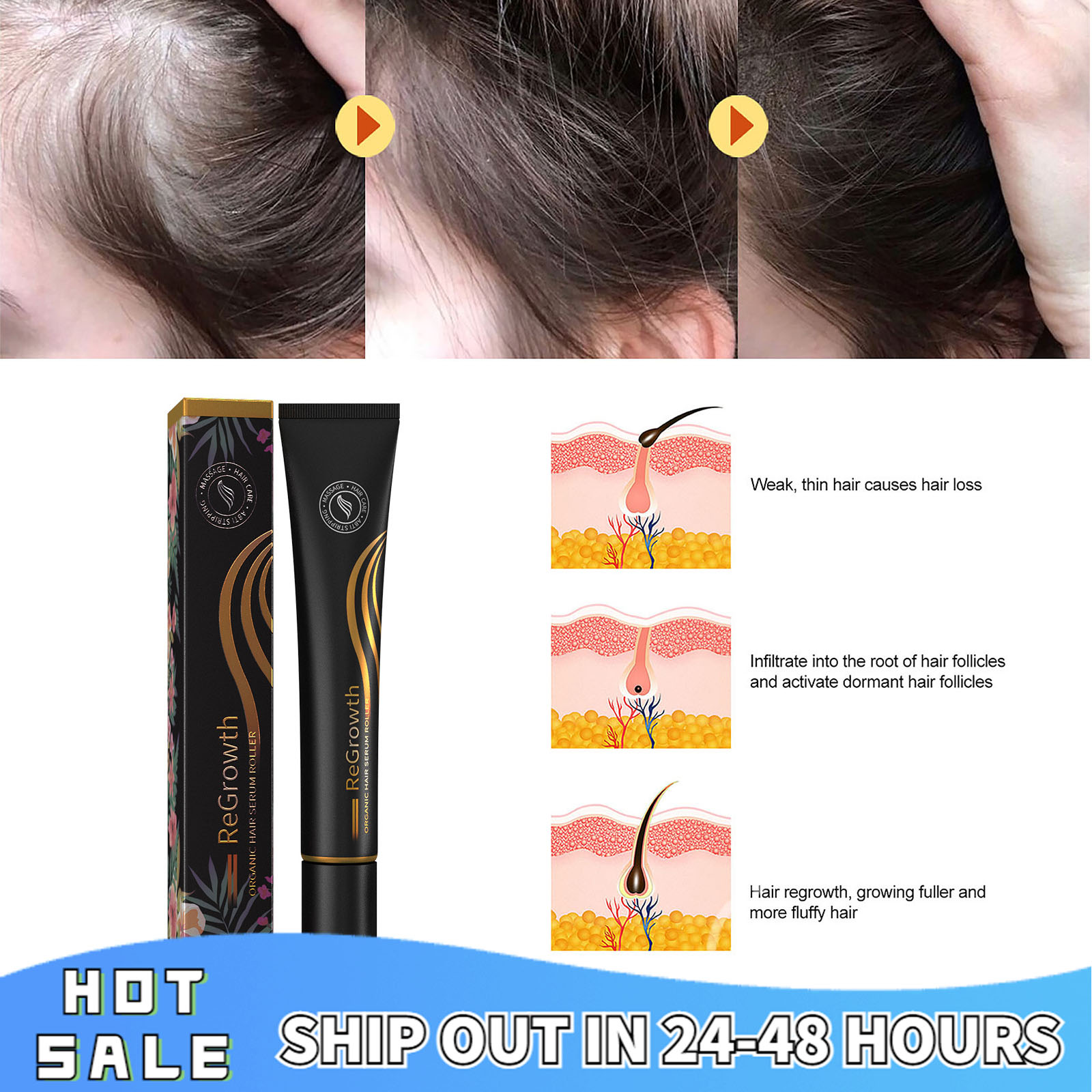 Ball Massage Anti - Removing Long Hair Solution To Improve The Strength Of  Hair, Prevent Broken Hair And Nourish Hair | Lazada PH