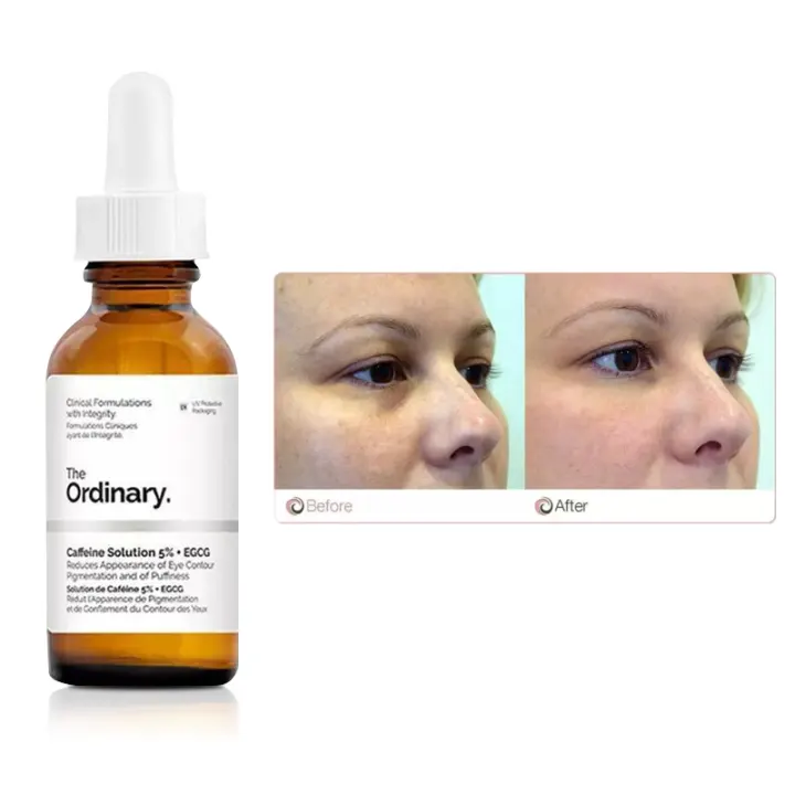 the ordinary caffeine solution wrinkles