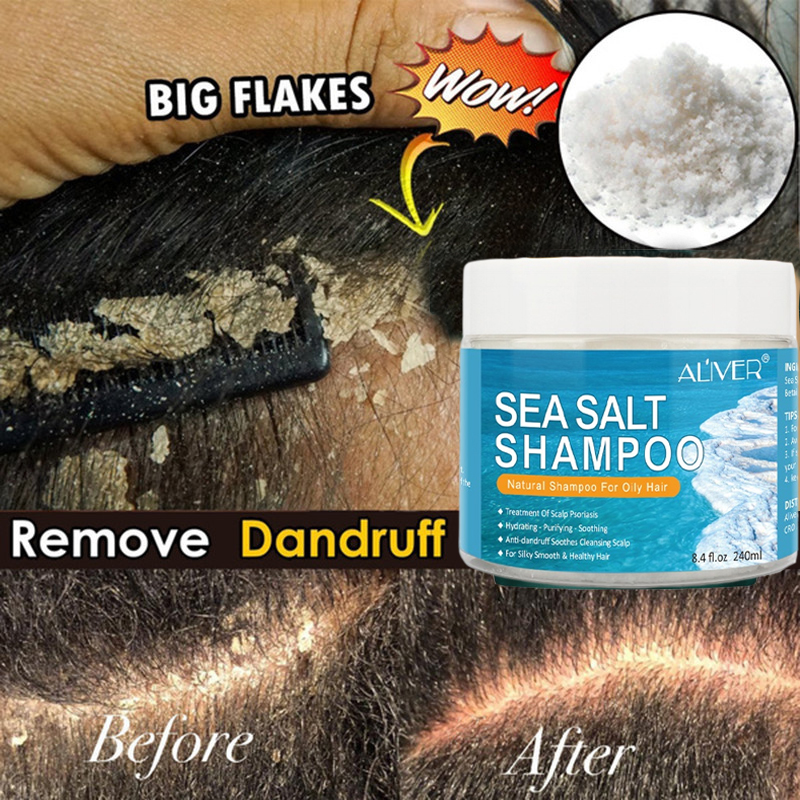 Aliver Shampoo For Scalp Psoriasis Sea Salt Shampoo Anti Dandruff