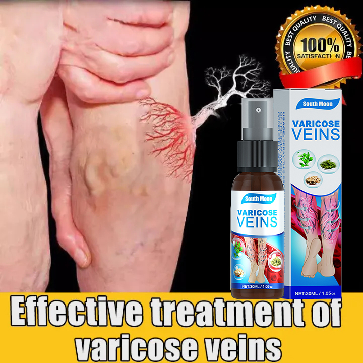 Southmoon Varicose Vein Treatment Cream Spray Ml Quick And Effective Relief From Painful Leg