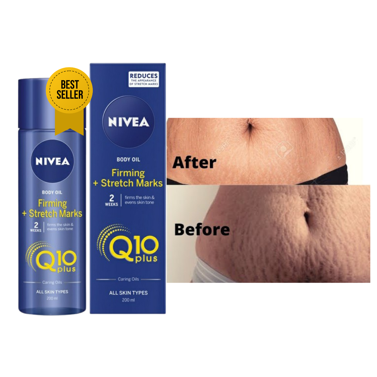 Does Nivea Clear Stretch Marks