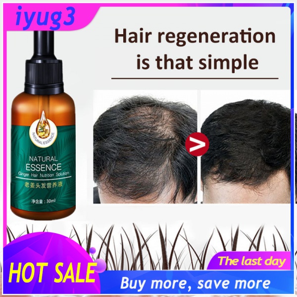 【Big Sale】Hair Grower For Men Original Castor Oil For Hair Growth Hair ...