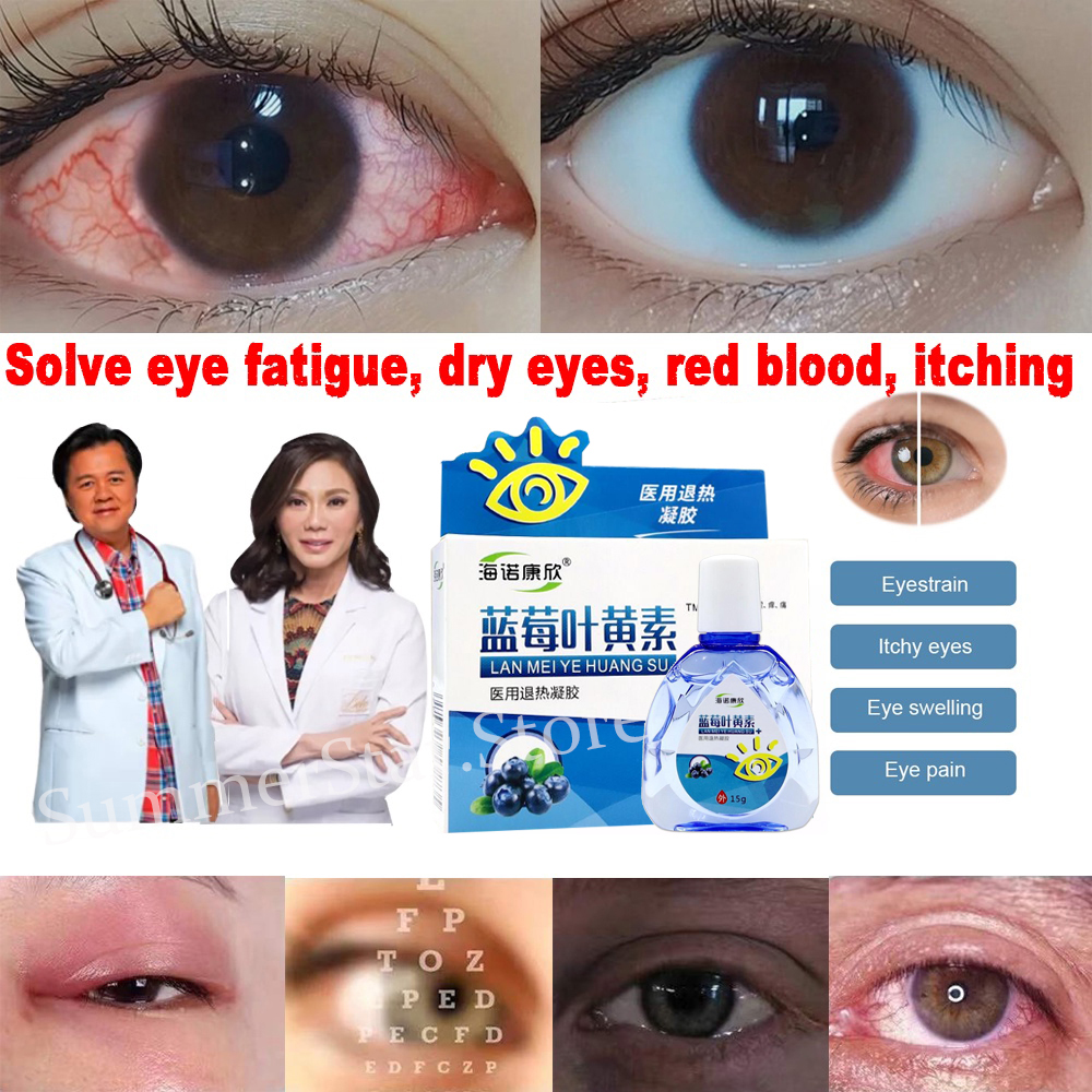 Original Blueberry Lutein Eye Drops Clear Vision Dry Eyes Hyperemia ...