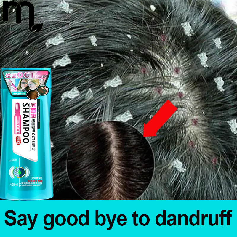 France OCT dandruff remover shampoo Removal Mites Shampoo Antiitch