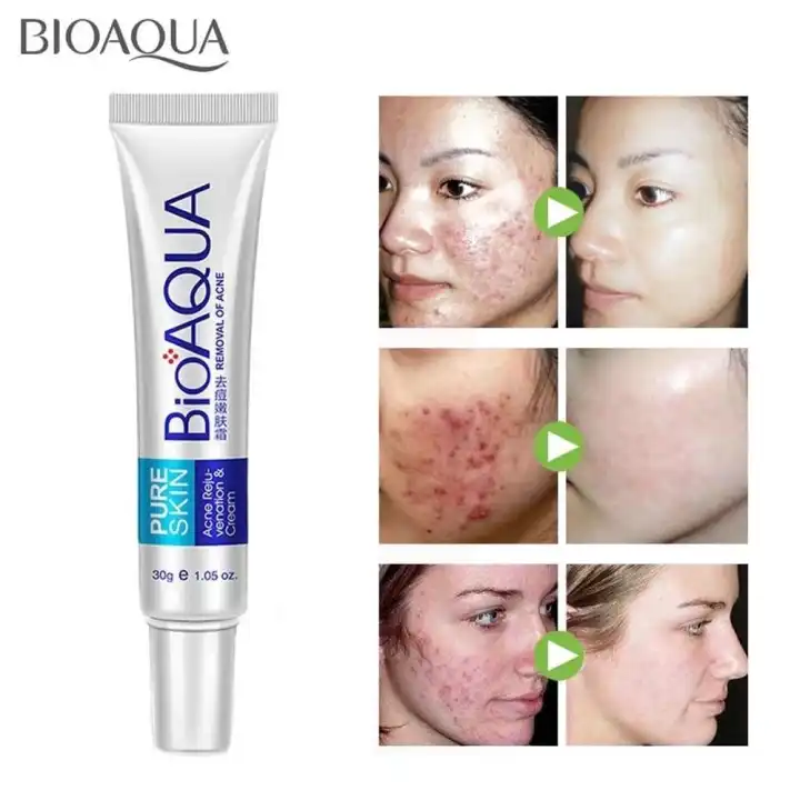 aqua cream for acne