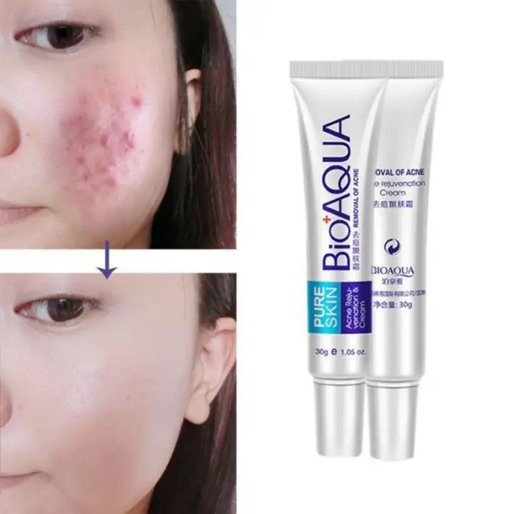 bioaqua acne rejuvenation cream ingredients