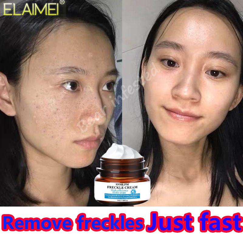 snmlpm freckle cream