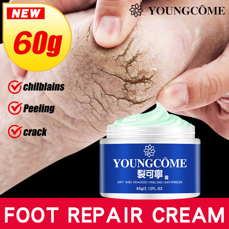 Foot Cream Moisturizer Peeling Heel Cream Peeling Feet Dry Skin On
