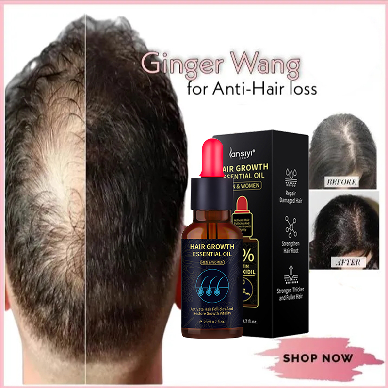 Minoxidil 5 Hair Grower Serum Original Hair Growth Minoxidil Hair