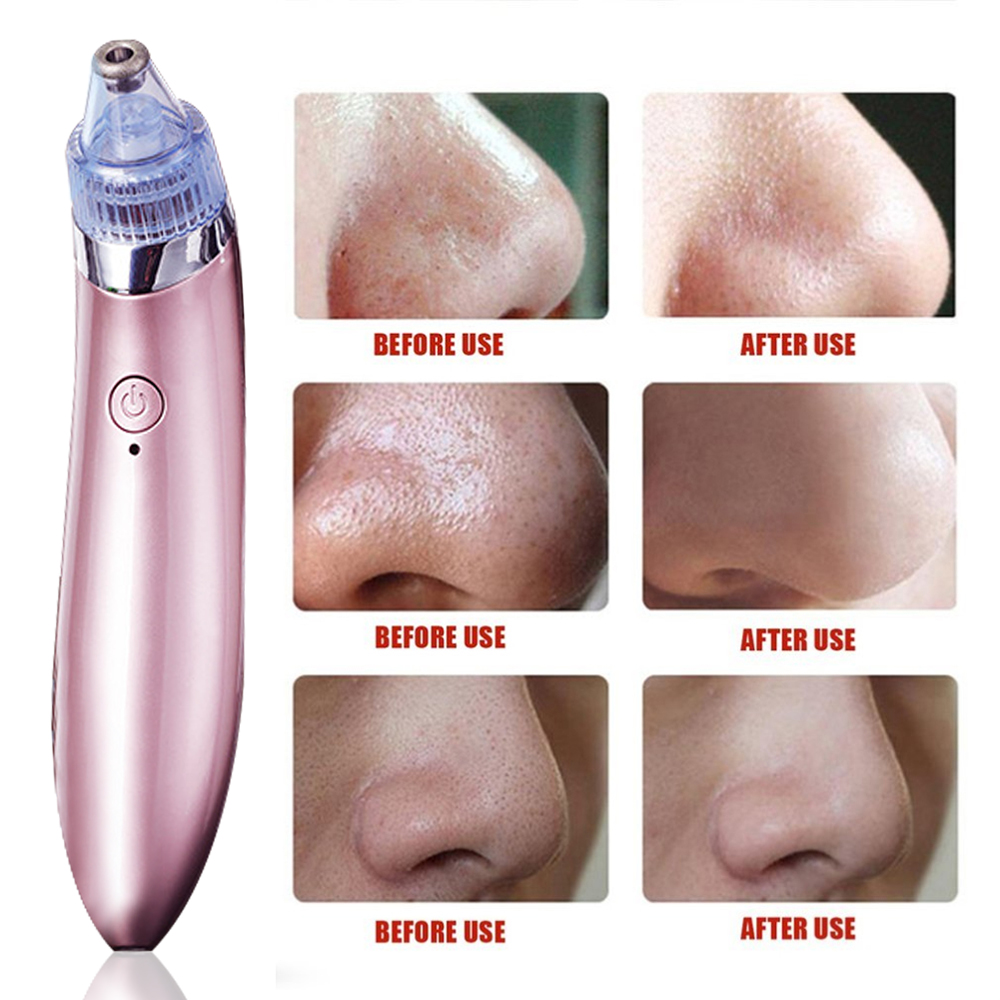 blackhead extractor vacuum