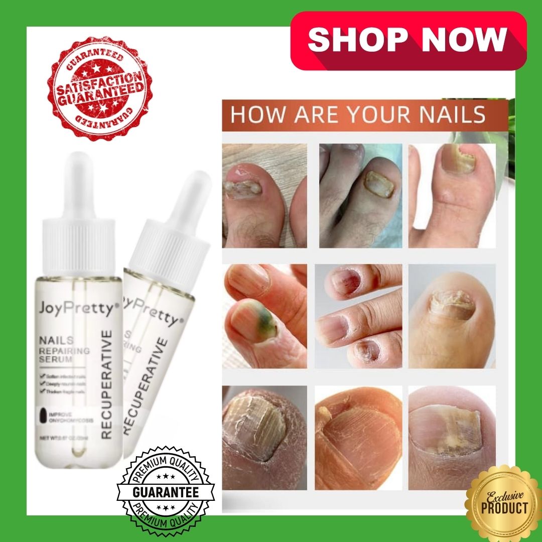 Joy Pretty | Nail Repairing Serum 20g | Grows Fingernails And Foot Nails |  Deeply Nourish Nails | Effective In Repairing Infected Nails And Soften  Nails | Helps in Whitening Toes Nail |