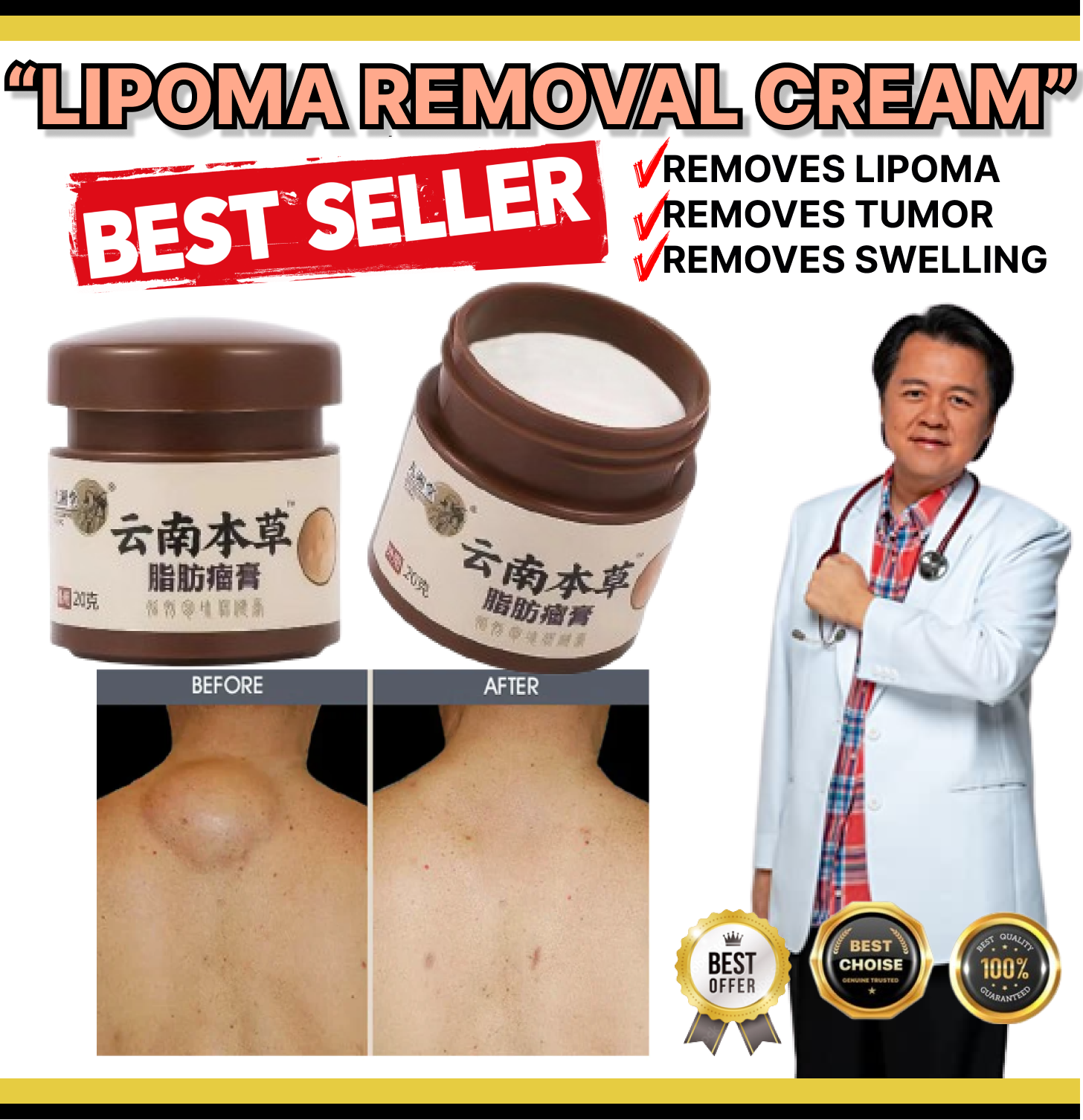 FAST EFFECT!! ON HAND!! Lipoma Removal Cream Treat Tumor Skin Swelling ...