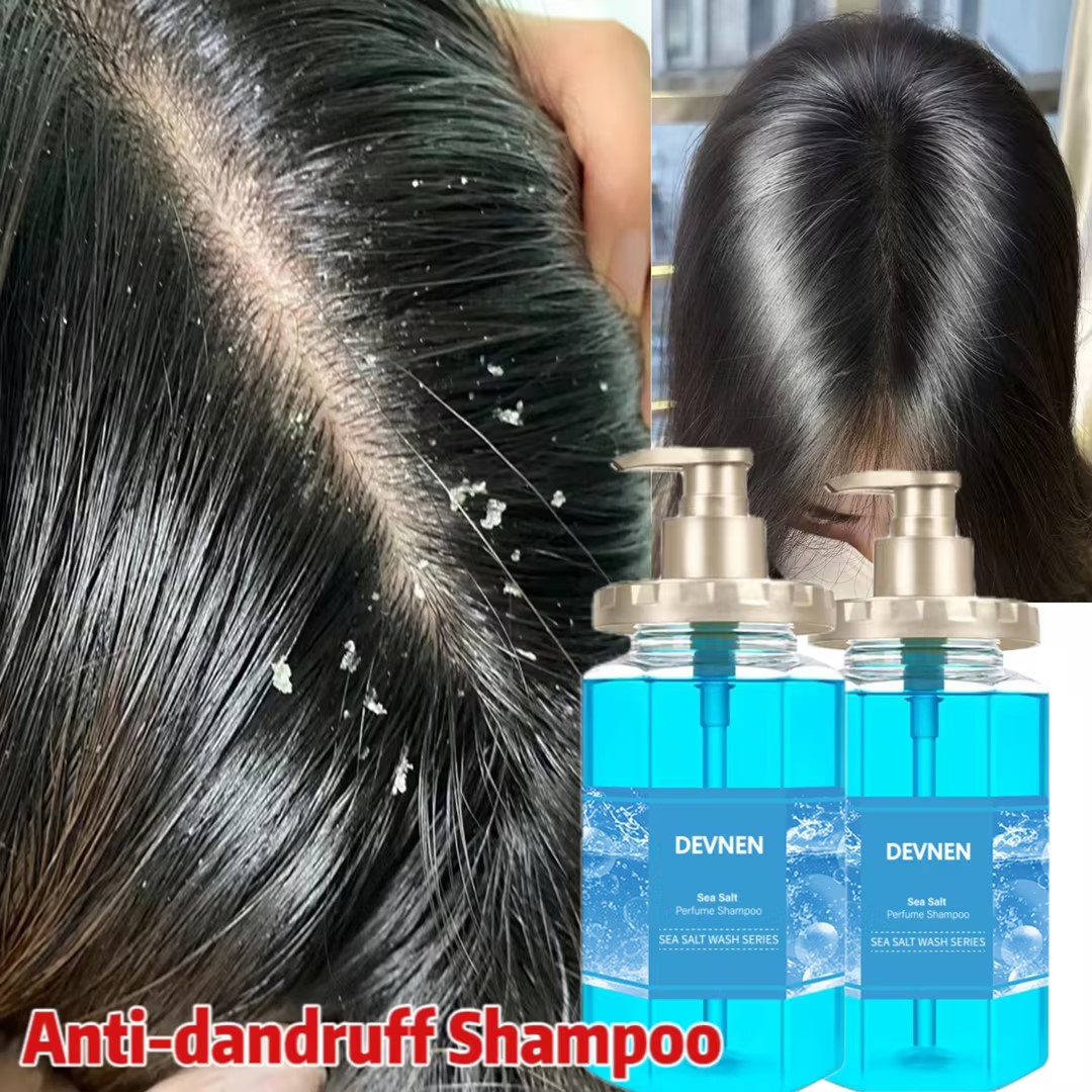 500ML anti sea salt scalp treatment vacuum para sa Fast results in 15 ...