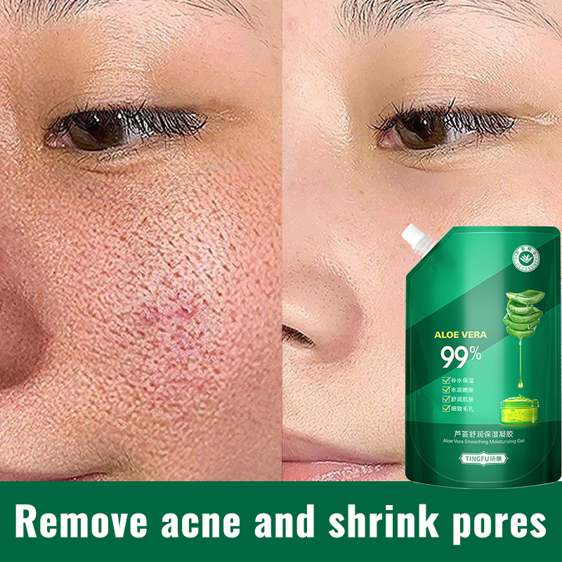 300ml-aloe-vera-soothing-gel-moisturizing-lighten-acne-marks-and-shrink