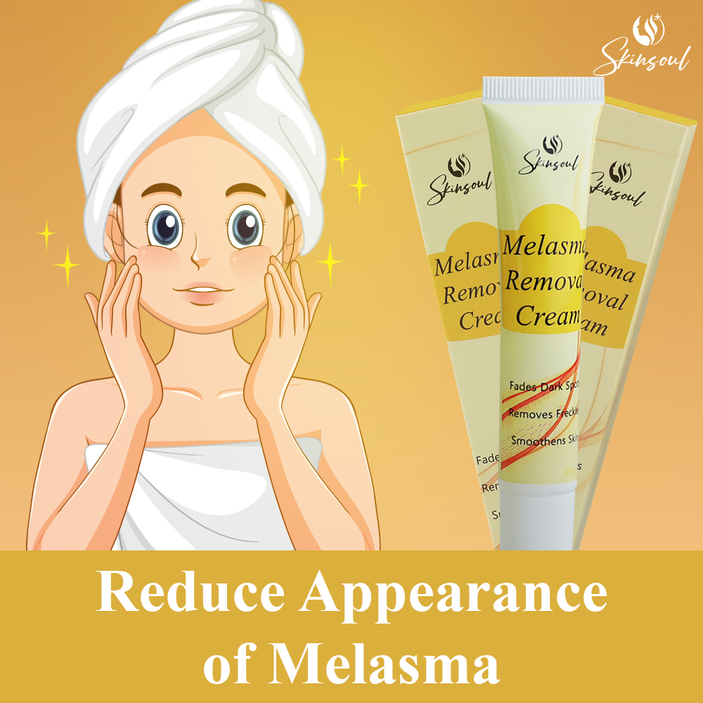 Skinsoul Melasma Remover Cream The Professional Melasma Removal Cream