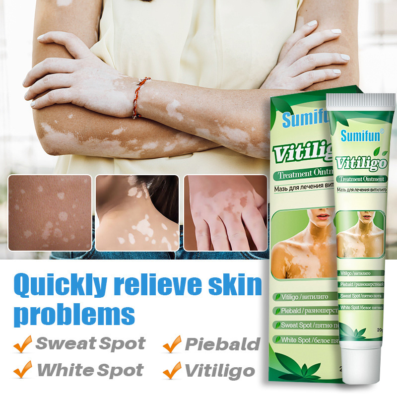 【Fast and Effective】 Vitiligo Cream Leukoplakia Disease Chinese Herbal