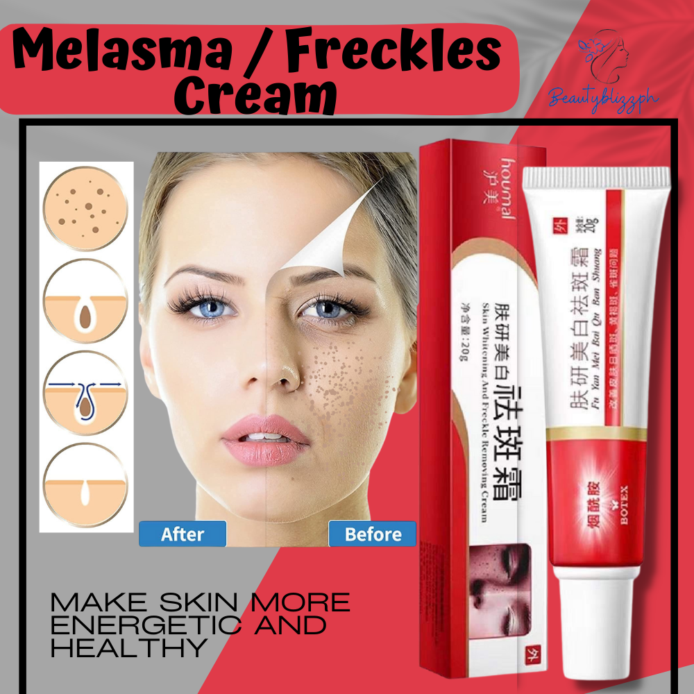 Original Melasma Anti Freckles Cream Dark Spot Corrector for face ...