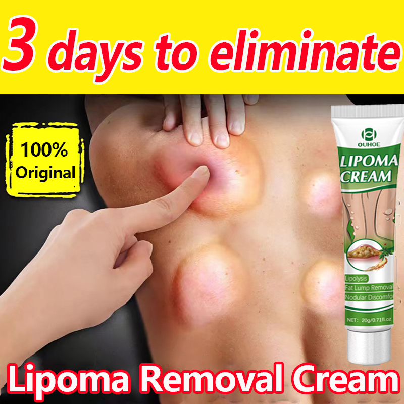 Painlesslipoma Removal Cream G Original Lipoma Cream Japan Lipoma Cream Original Fat Lump
