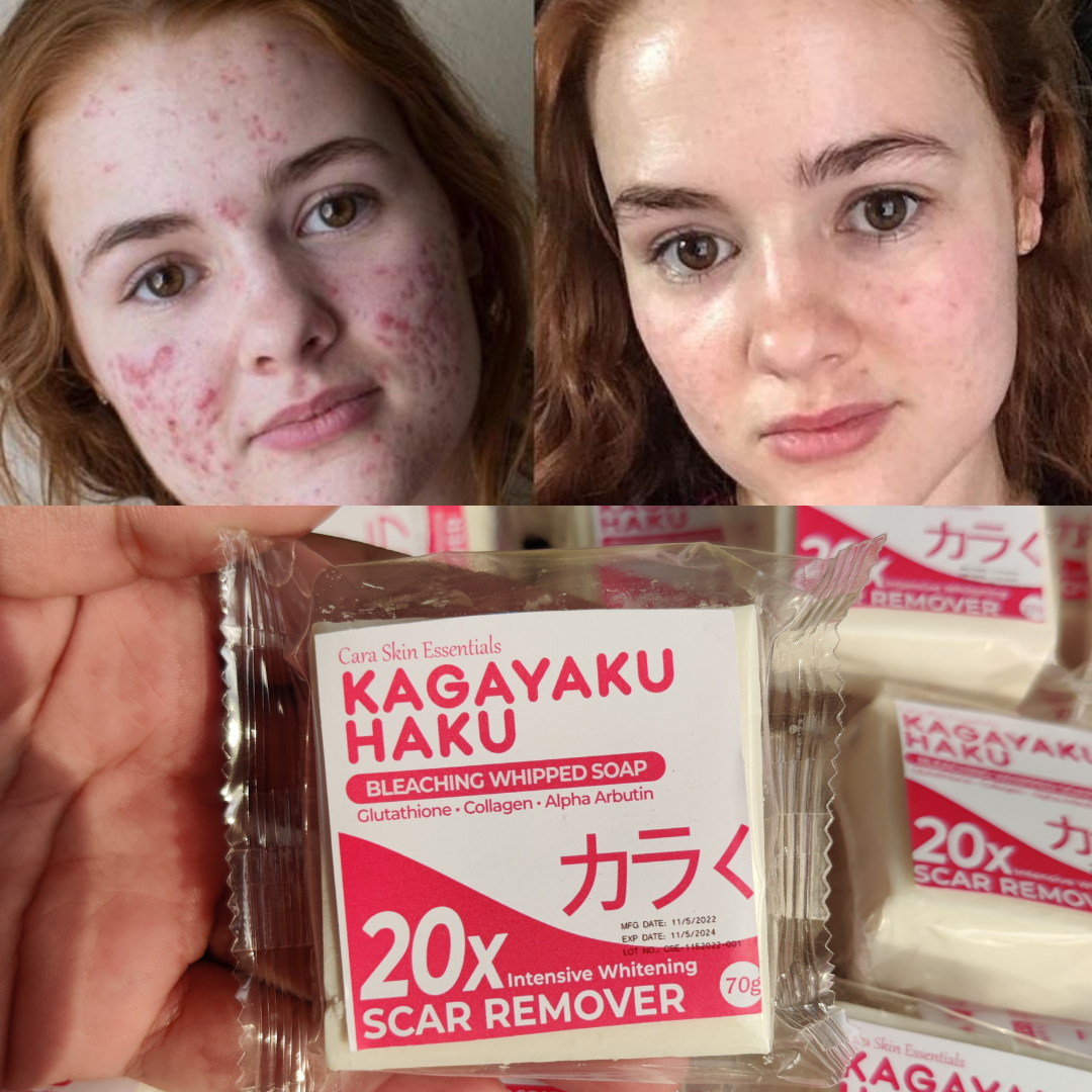 10000x whitening effect premium Korean Kagayaku soap, 100 pure and