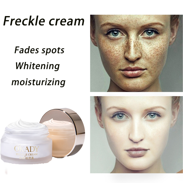 cream for freckles and age spots