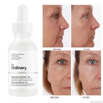 the ordinary hydraulic acid serum