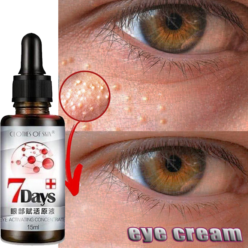 【Fast Effective】 Original Dark Eye Circle Remover Eye Bags Remover Eye