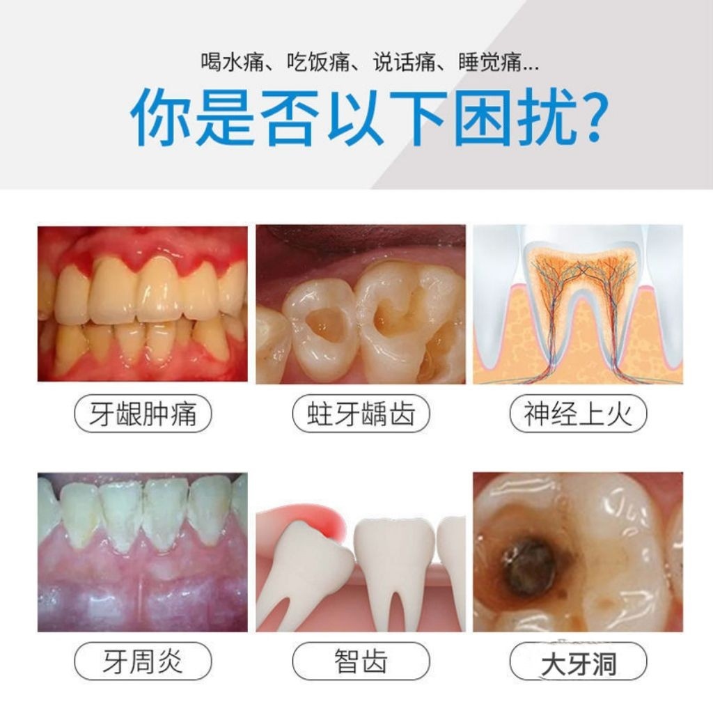 After tooth extraction mouthwash special inflammatory medicine for