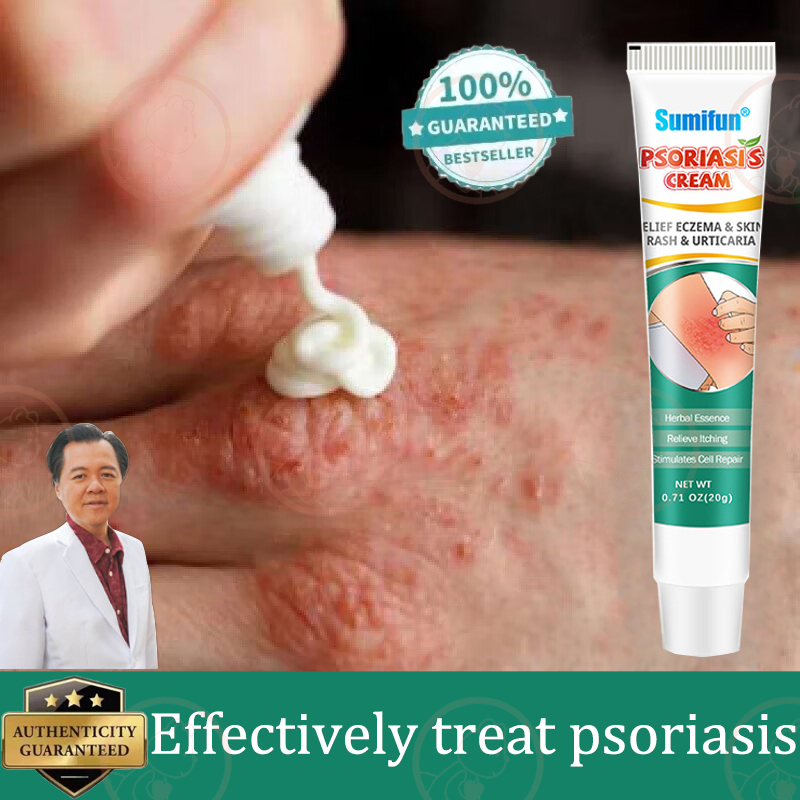 【Sumifun】 Psoriasis Cream Antibacterial Cream Eczema Ointment Eczema