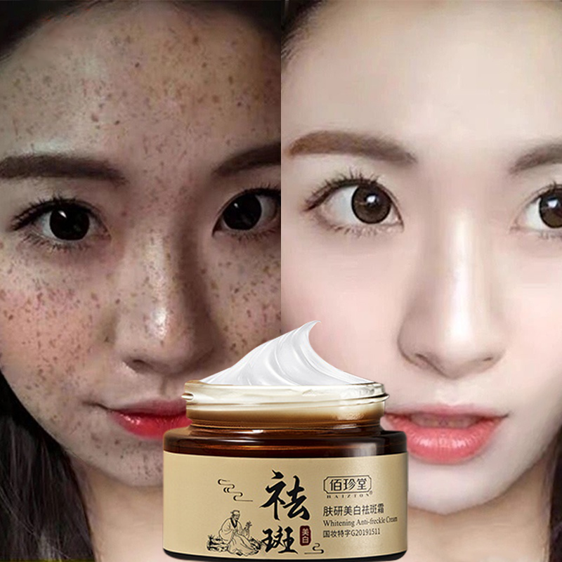 30g Whitening Freckle Dark Spot Remover Melasma Removal Cream Original ...