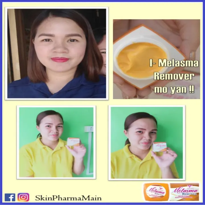 best cream for face stains