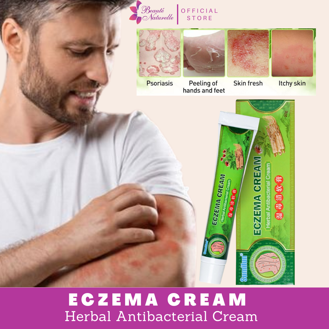 Safe And Effective Eczema Herbal Antibacterial Treatment Cream Gamot Sa Kati Kati Sa Balat Buni 9209