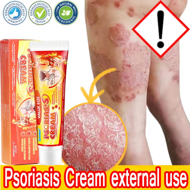 Sumifun Psoriasis Cream Natural Herbal Antibacterial Cream Treat Skin Rashes Stop Itching And