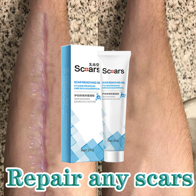 100 Effective keloid Scar Remover cream scar gel original Surgical