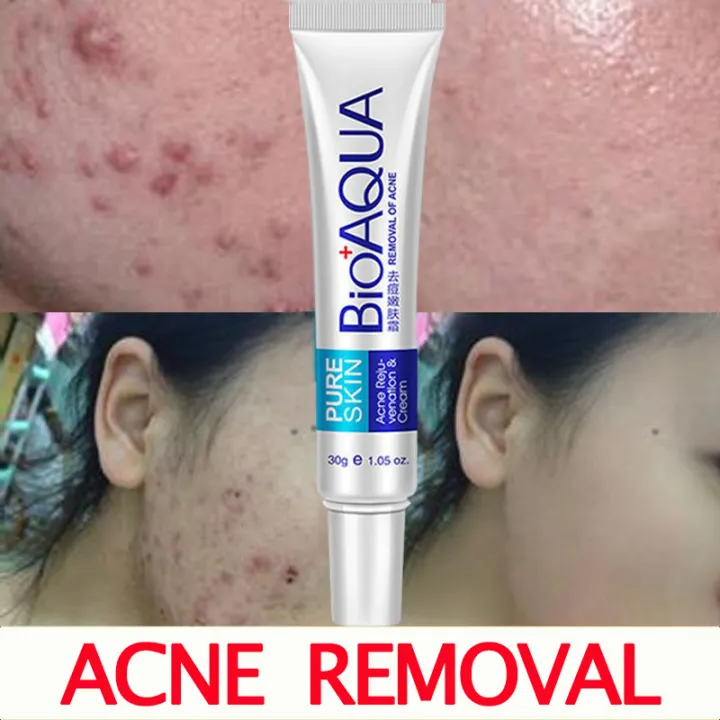 moisturizer for acne scars