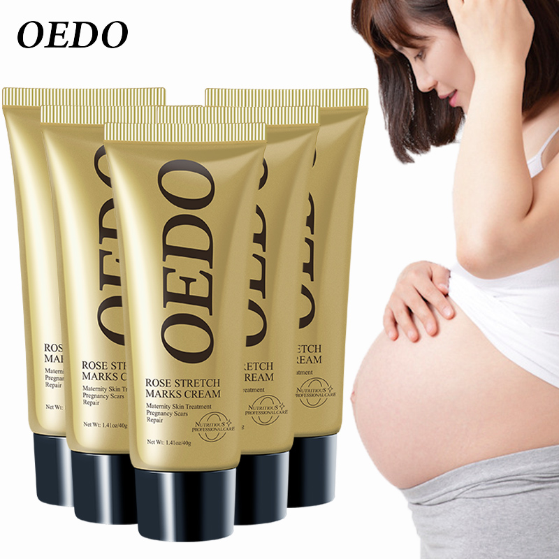cara menggunakan oedo rose remove stretch mark cream