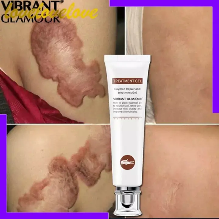 anti aging scar cream