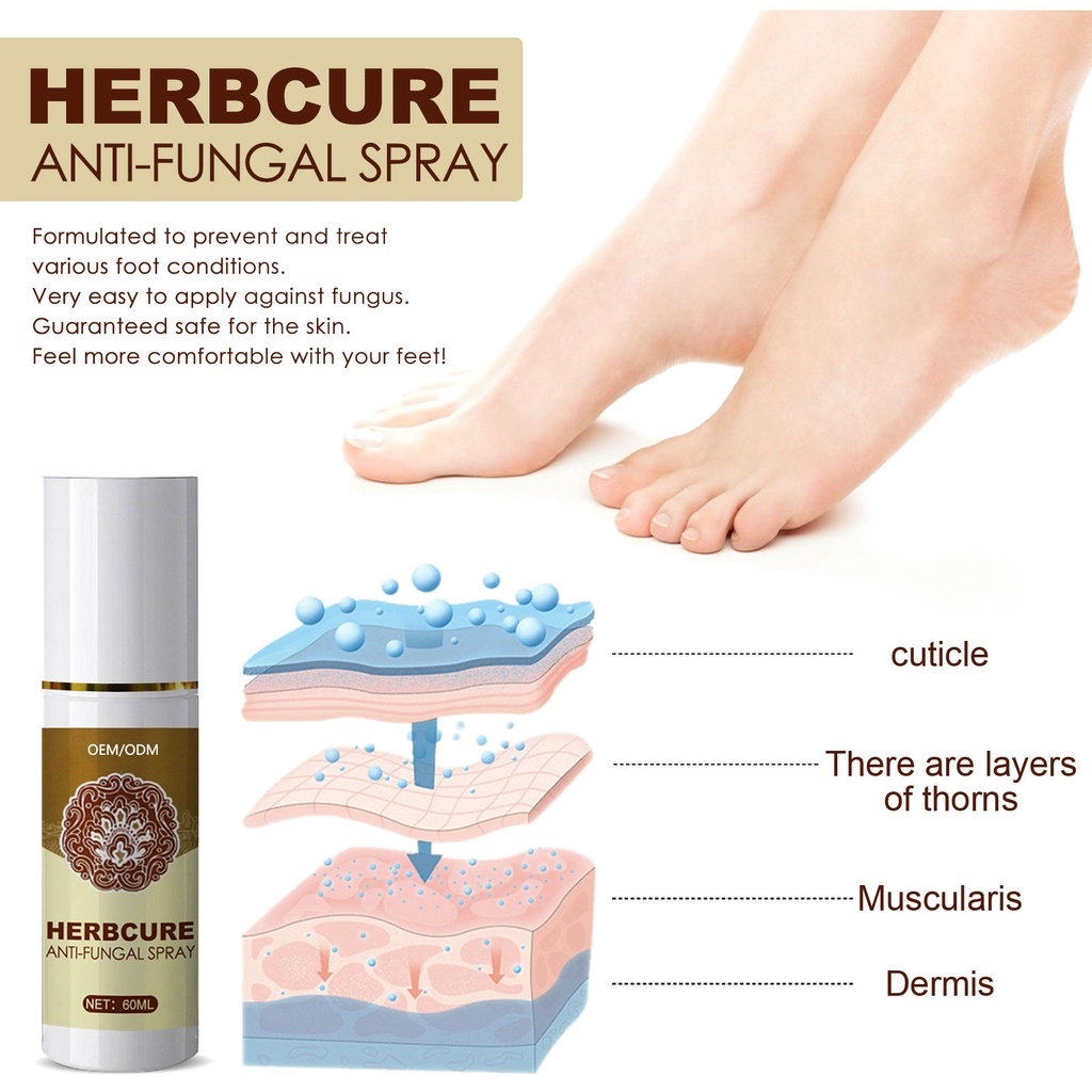 Herbcure Anti Fungal Spray Sweat Foot Odor Remover Feet Care Foot Spa