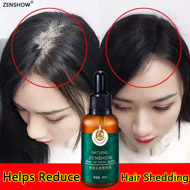 Hair serum 30ml hair growth essence Strengthen The Nutrition Of Hair  Prevent Baldness make hair roots stronger Effectively stimulate and  accelerate hair growth(growth essential oil,care hair growth oil,hair  grower,Hair Thickener | Lazada