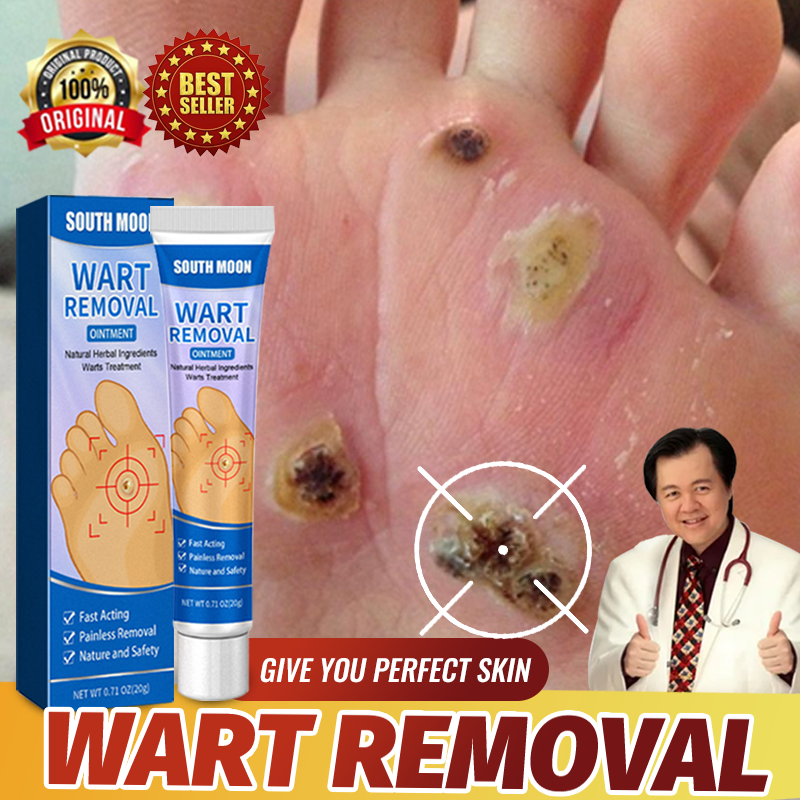 Warts Remover Original Watson Warts Removal Original Cream Skin Tags And Warts Remover Original