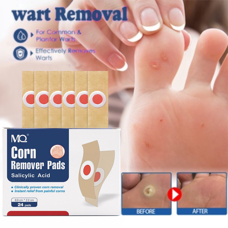 Warts Remover Patch 24 /box Pain Relief Remove Calluses On Hands And ...