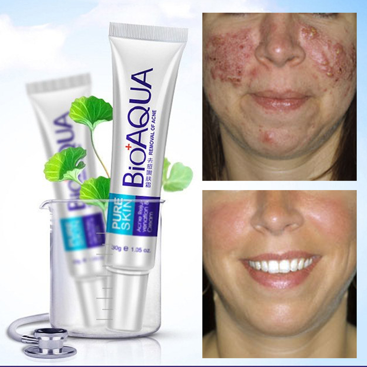 bioaqua cream blackhead remover