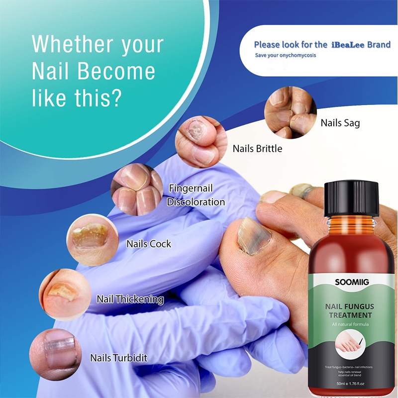 Nail Fungus Treatment Feet Care Essence Nails Foot Repair Toe Nail